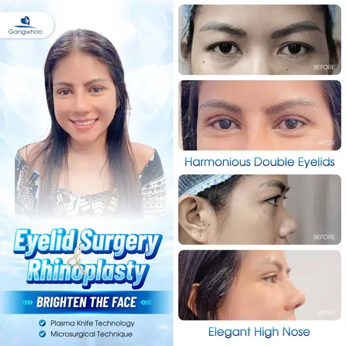 2025 Top Rhinoplasty Techniques