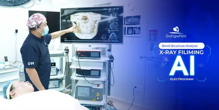 2025 Top Rhinoplasty Techniques