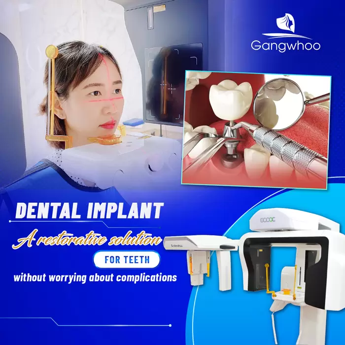 Dental Implant – For A Perfect Set Of Teeth
