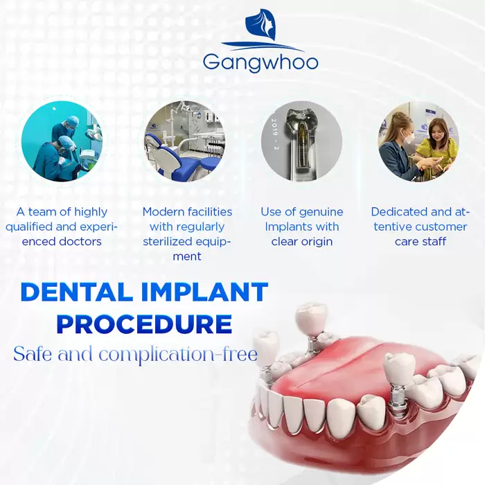 Dental Implant – For A Perfect Set Of Teeth