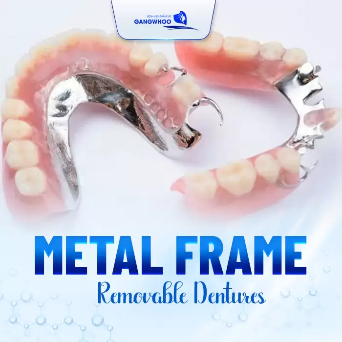 Dentures Reinstall and Recovery
