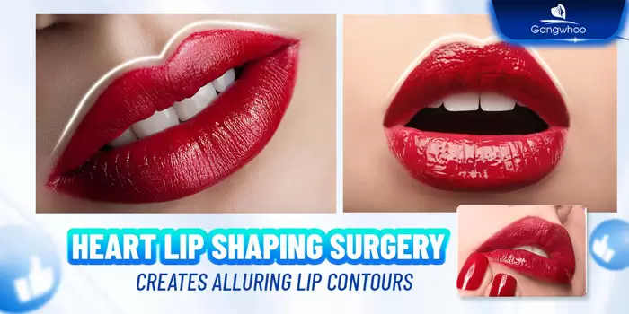 Heart Lip Shaping – Sexier Lips, Sexier Charm