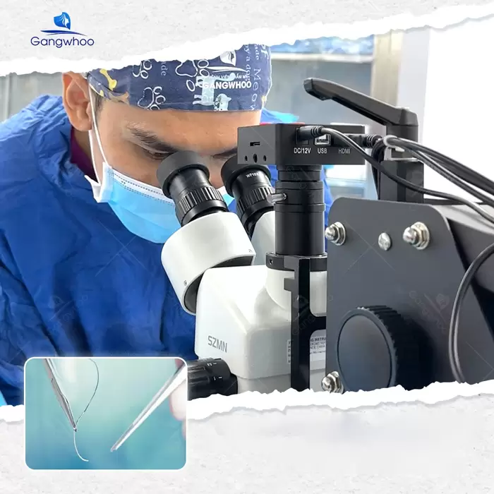 Medial Canthoplasty – For Charming and Flawless Eyes