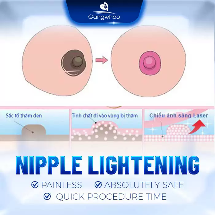Nipple Lightening – Brighten Your Time With Him