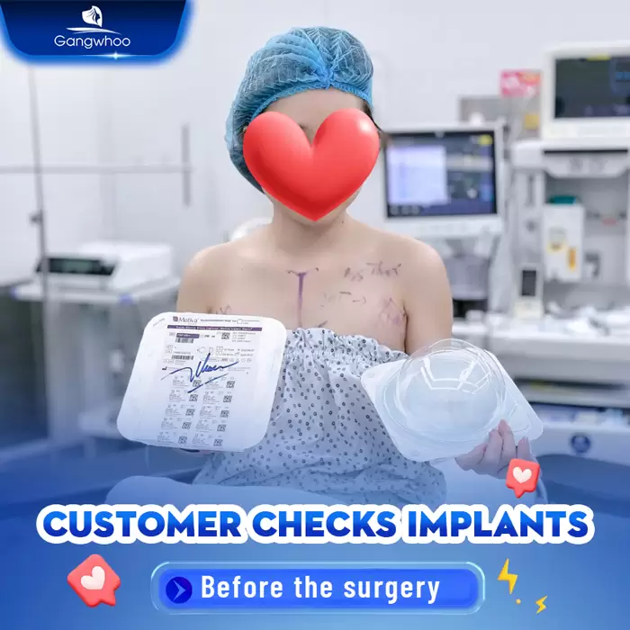Laparoscopic Breast Augmentation with Nanochip Implant – For A Natural Breast Form
