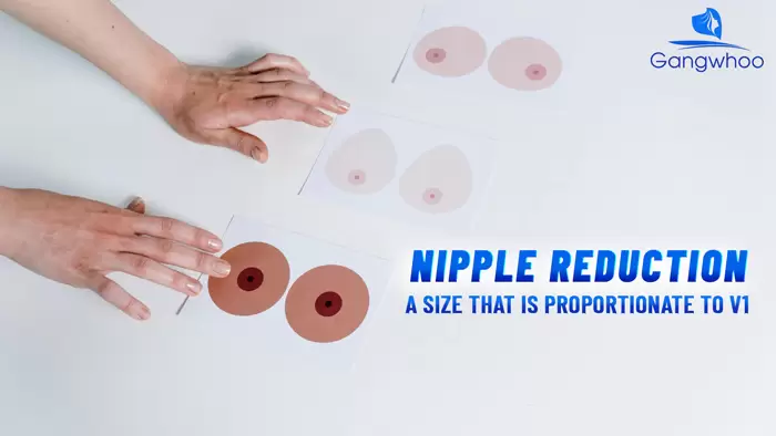 Nipple Reduction – Petite and Pretty