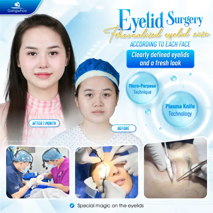 Eyelid Method Blepharoplasty – Bring To You The Most Charming Beauty