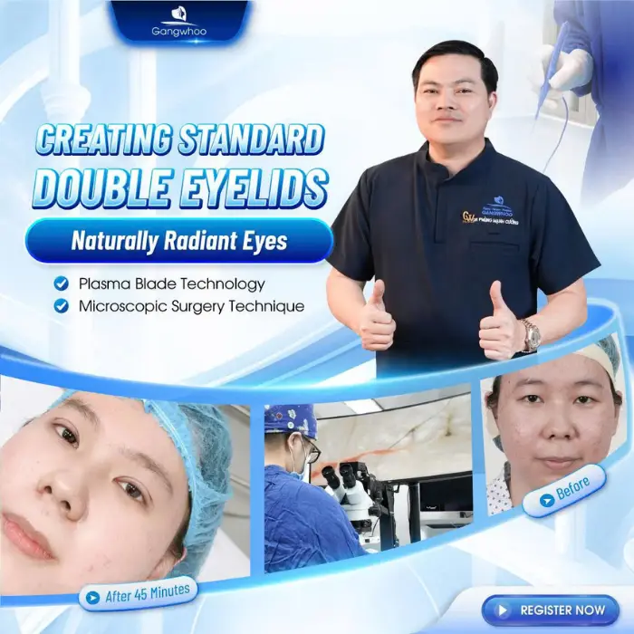 Korean Non-incisional Blepharoplasty – Possess The Beauty Of A Korean Star