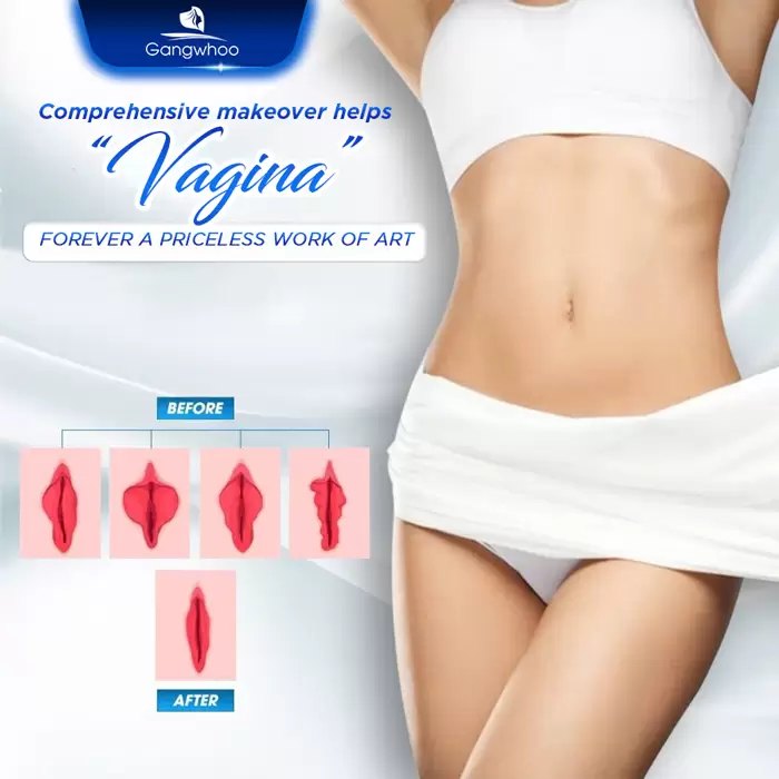 Labia Majora and Minora Reduction – More Confident In Yourself After Giving Birth