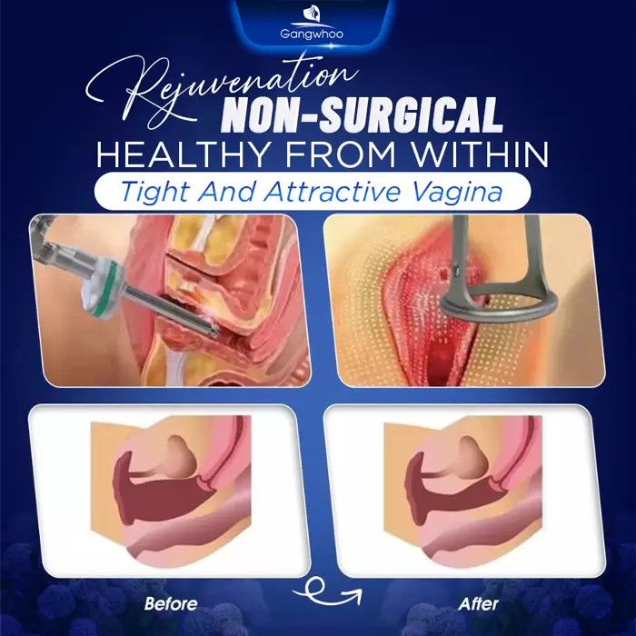 Genital Rejuvenation Using Laser – Make Yourself Younger and Sexier