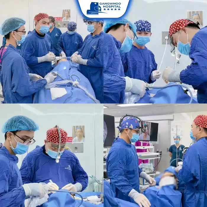 Perineoplasty – Be Sexier, Be More Charming