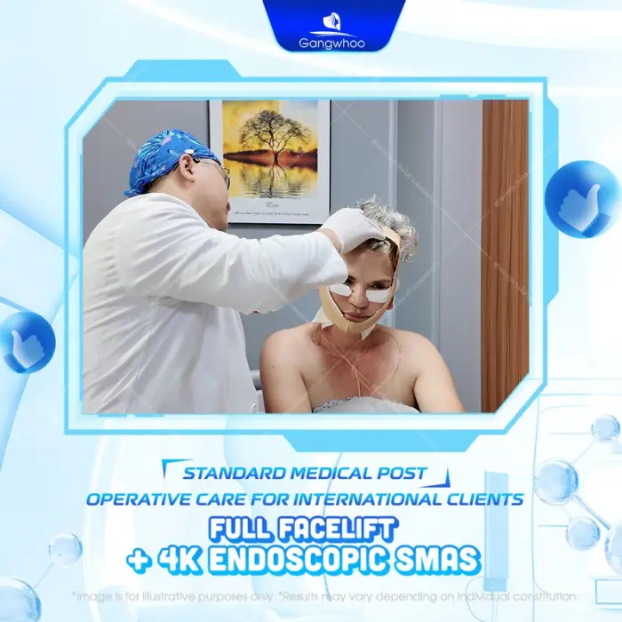 SMAS FACELIFT – LIFE-CHANGING RESULT AFTER ONLY 1 AMAZING PROCEDURE