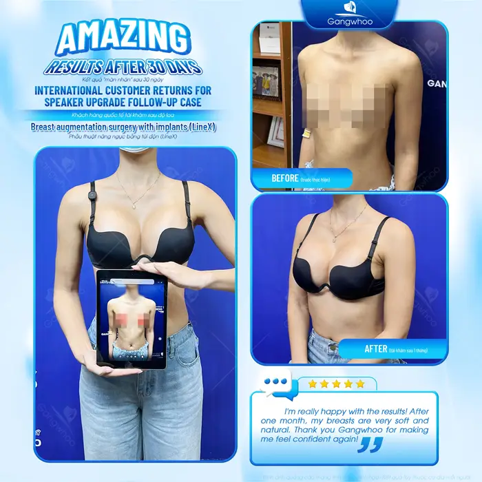 BREAST LIFT OR BREAST AUGMENTATION: WHICH ONE IS BEST-FITTED FOR YOUR BEAUTY