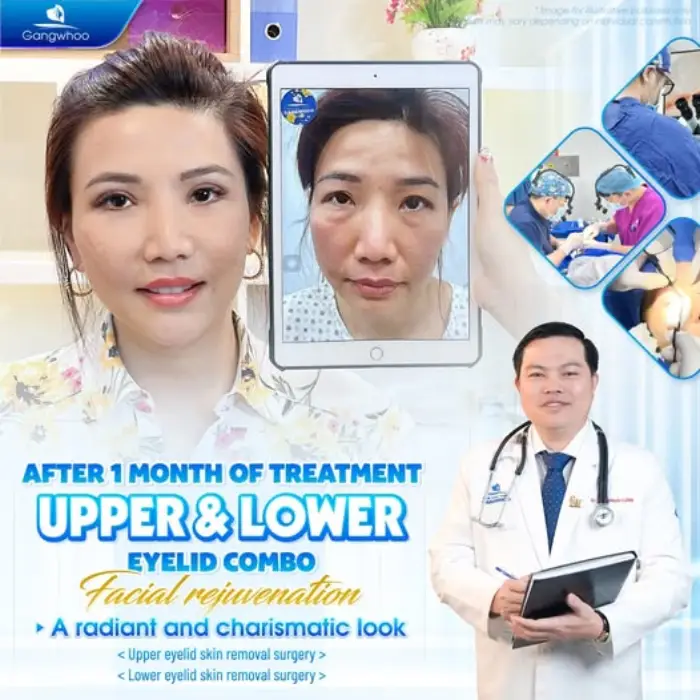 LOWER BLEPHAROPLASTY – HOW PAINFUL AND IS IT WORTH IT?