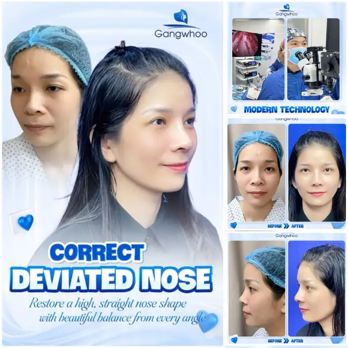 RHINOPLASTY RESULTS – HOW LONG DOES IT TAKE TO ARCHIVE YOUR DESIRED ONE?