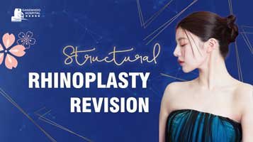 Structural rhinoplasty revision