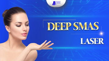 Deep SMAS laser