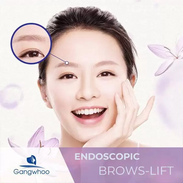 Endoscopic Browplasty – Chasing Away Signs Of “Aging”