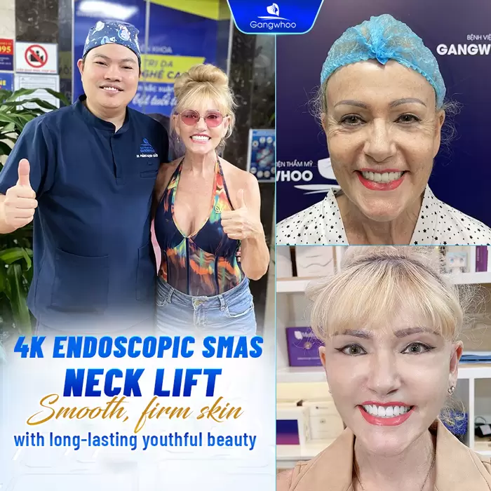 Necklift – A Great Way to Get Rid of Neck Wrinkles