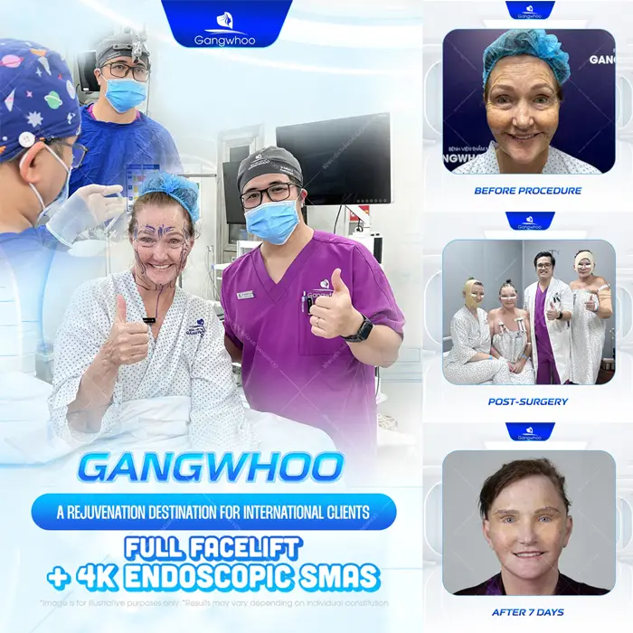 Gangwhoo – Prestigious Facelift Hospital For Overseas Vietnamese