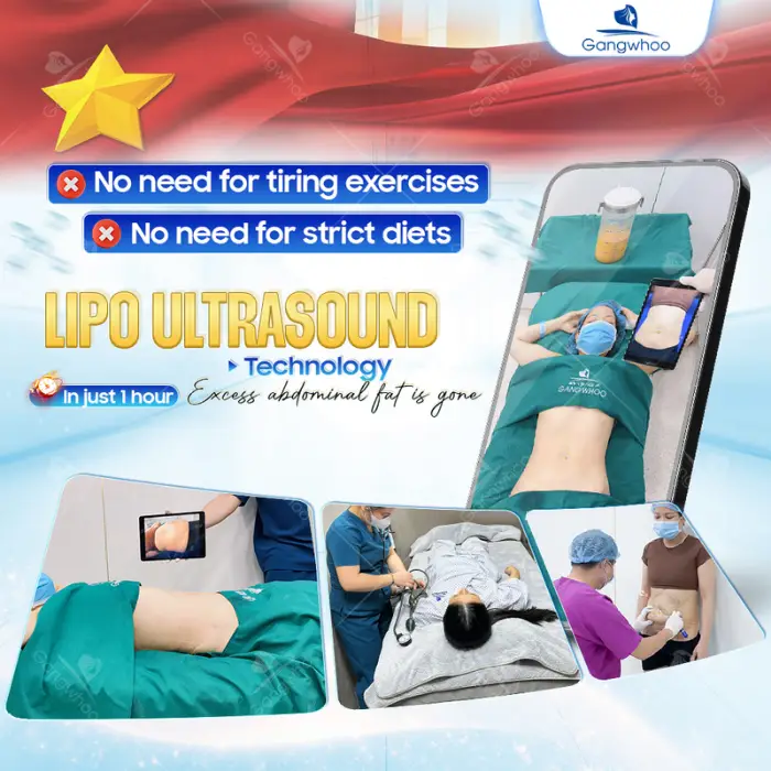 Fat Reduction using Ultra Slim – The World’s Number One Healthy Fat Removal Technique in the United States