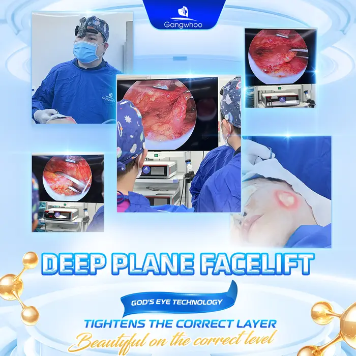 Deep Plane Facelift – The Secret to Safe and Superior Skin Rejuvenation