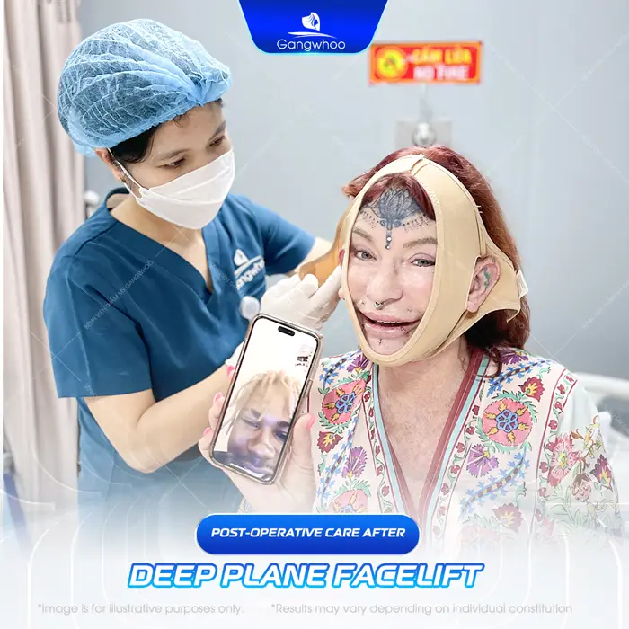 Deep Plane Facelift – The Secret to Safe and Superior Skin Rejuvenation