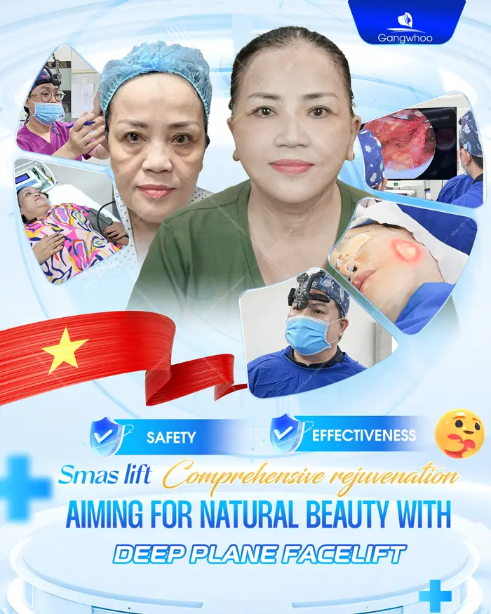 Deep Plane Facelift – The Secret to Safe and Superior Skin Rejuvenation