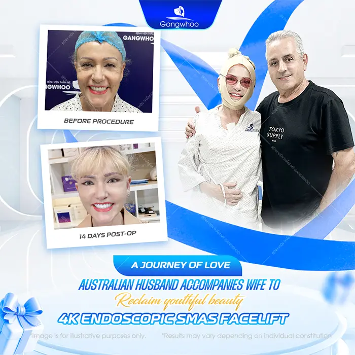 How Long Should You Wear a Facial Compression Band After a Facelift?