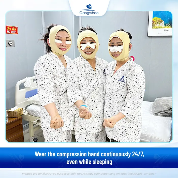 How Long Should You Wear a Facial Compression Band After a Facelift?