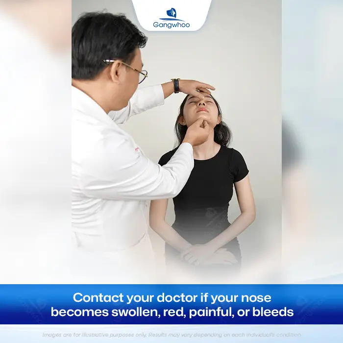 How Long After Rhinoplasty Can You Pick Your Nose? Safe Cleaning Guidelines
