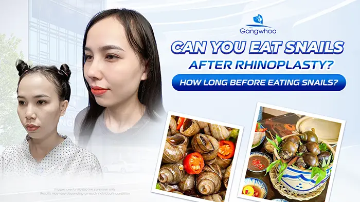 Can You Eat Snails After Rhinoplasty? How Long Should You Wait?