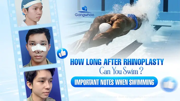 How Long After Rhinoplasty Can You Go Swimming? Important Medical Guidelines