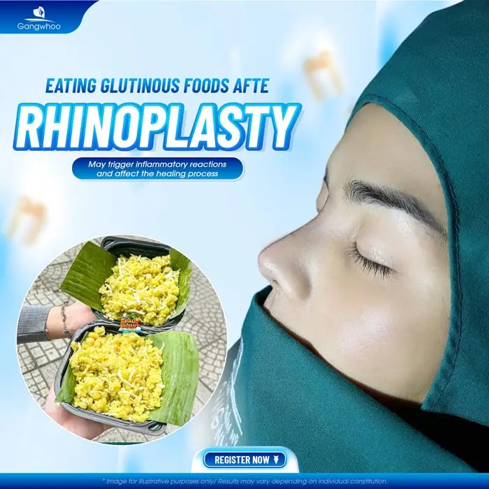 How Long After Rhinoplasty Can You Eat Sticky Rice? Doctor Explains