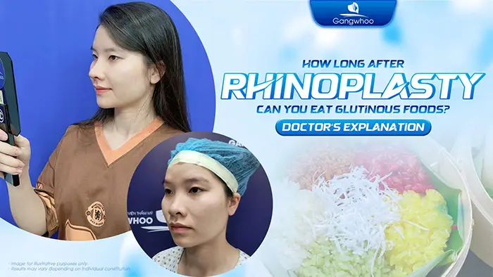 How Long After Rhinoplasty Can You Eat Sticky Rice? Doctor Explains