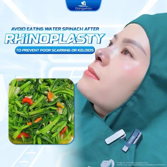 How Long After a Nose Job Can You Eat Water Spinach? Doctor’s Advice
