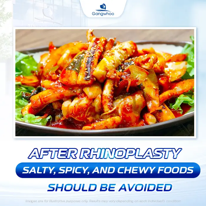 How Long After Rhinoplasty Can You Eat Soy Sauce? Why Should Soy Sauce Be Avoided?