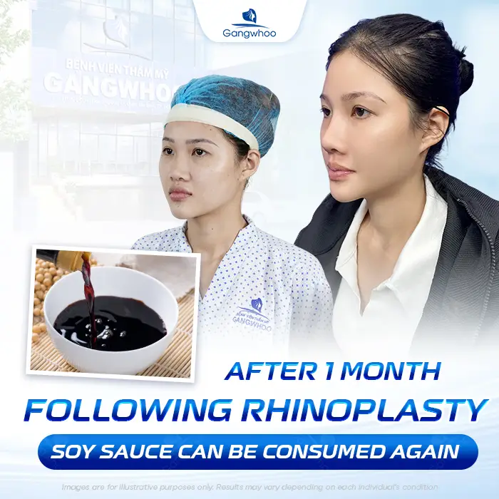 How Long After Rhinoplasty Can You Eat Soy Sauce? Why Should Soy Sauce Be Avoided?