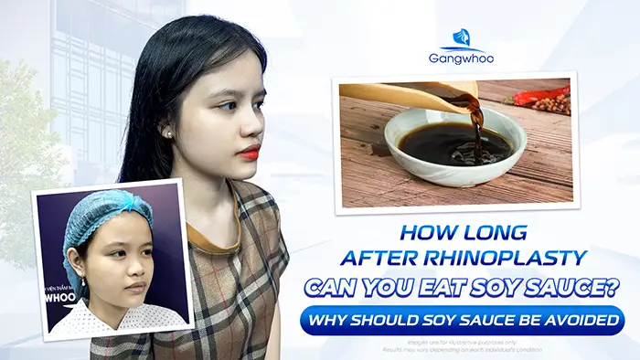 How Long After Rhinoplasty Can You Eat Soy Sauce? Why Should Soy Sauce Be Avoided?