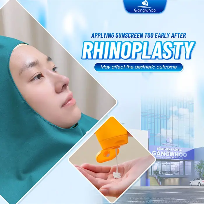 How Long After Rhinoplasty Can You Apply Sunscreen? Doctor’s Answer