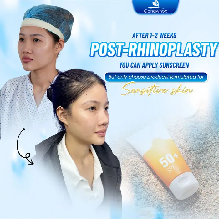 How Long After Rhinoplasty Can You Apply Sunscreen? Doctor’s Answer