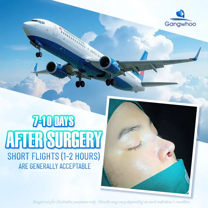 How Long After a Nose Job Can You Fly? Domestic & International Flight Guidelines