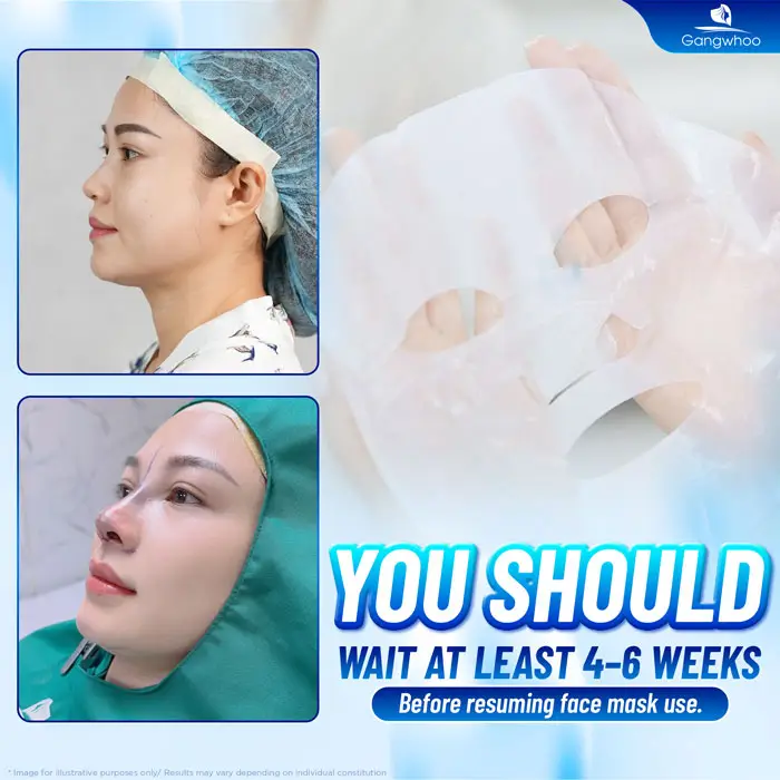 How Long After Rhinoplasty Can You Use Face Masks? Skincare Tips for Safe Recovery