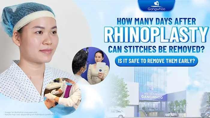 How Many Days After Rhinoplasty Can the Stitches Be Removed? Is It Dangerous to Remove Them Early?