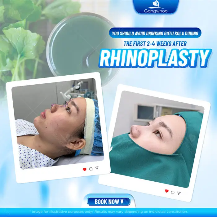 Can You Drink Gotu Kola After Rhinoplasty? Benefits and Risks
