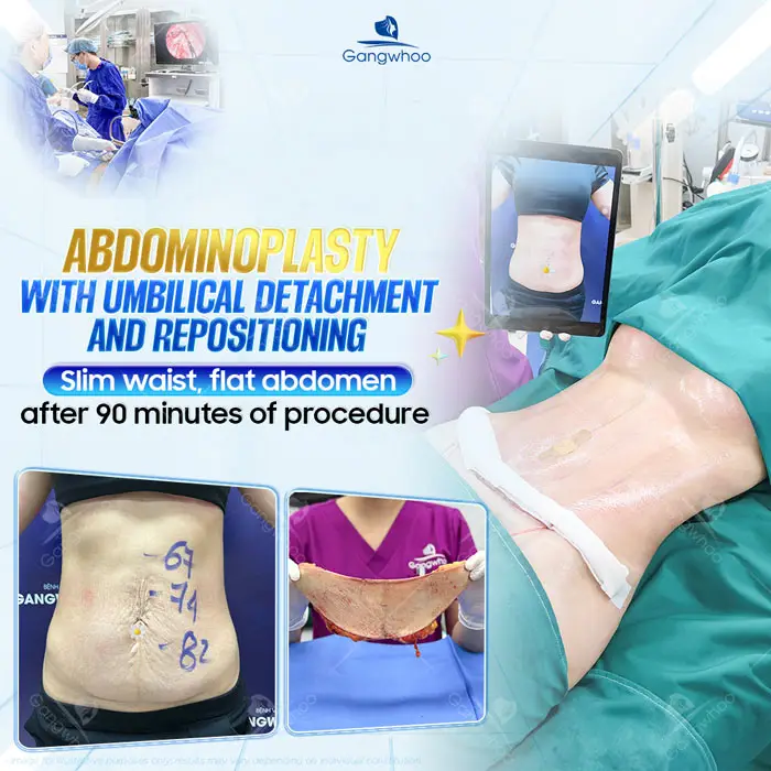 Tummy Tuck Surgery: How Much Does It Cost? Updated 2025 Price List