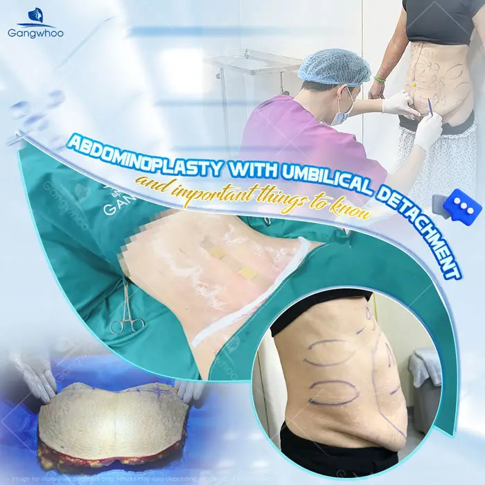 Tummy Tuck Surgery: How Much Does It Cost? Updated 2025 Price List