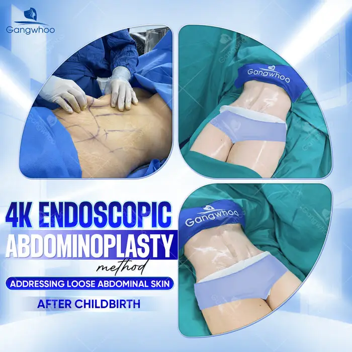 Tummy Tuck Surgery: How Much Does It Cost? Updated 2025 Price List