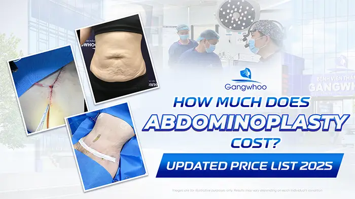 Tummy Tuck Surgery: How Much Does It Cost? Updated 2025 Price List