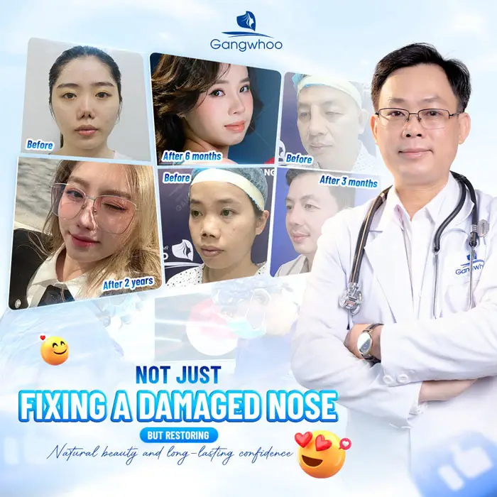 How Much Does Nose Revision Surgery Cost? 2025 Nose Revision Price Guide